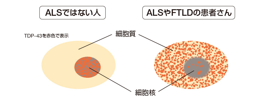 図2：神経細胞内におけるTDP-43（イメージ図）