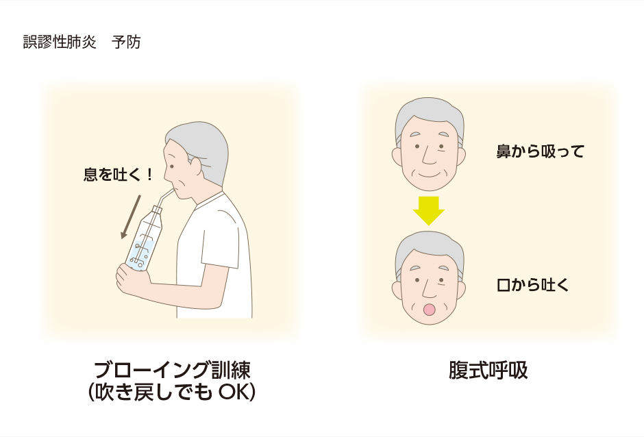 図7-a：誤嚥性肺炎予防のためのプログラム
