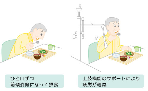 図2：腕のサポート装具